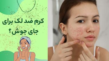 کرم ضد لک برای جای جوش