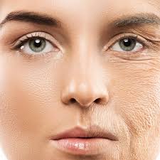 چگونه چین و چروک‌ها را کاهش دهیم 