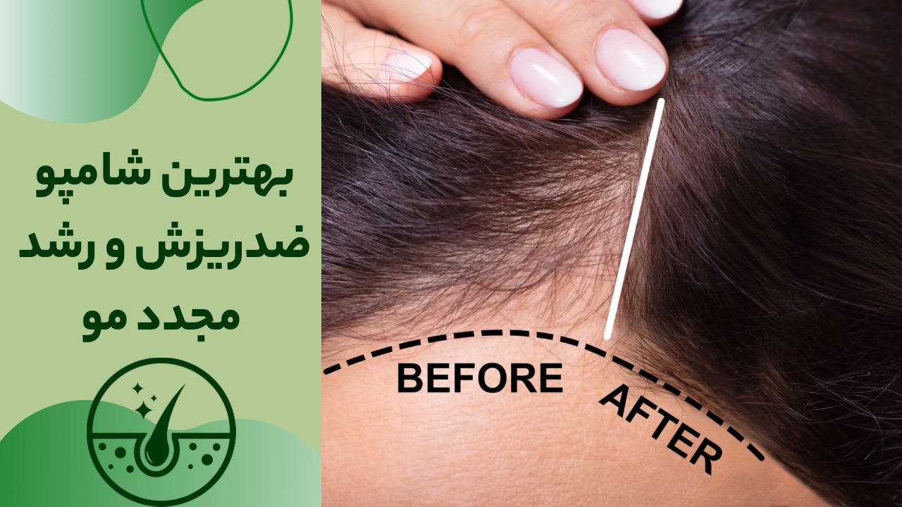 بهترین شامپو ضد ریزش و رشد مجدد مو